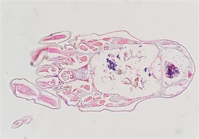 Investigating the microbiome of house dust mites in South Korea